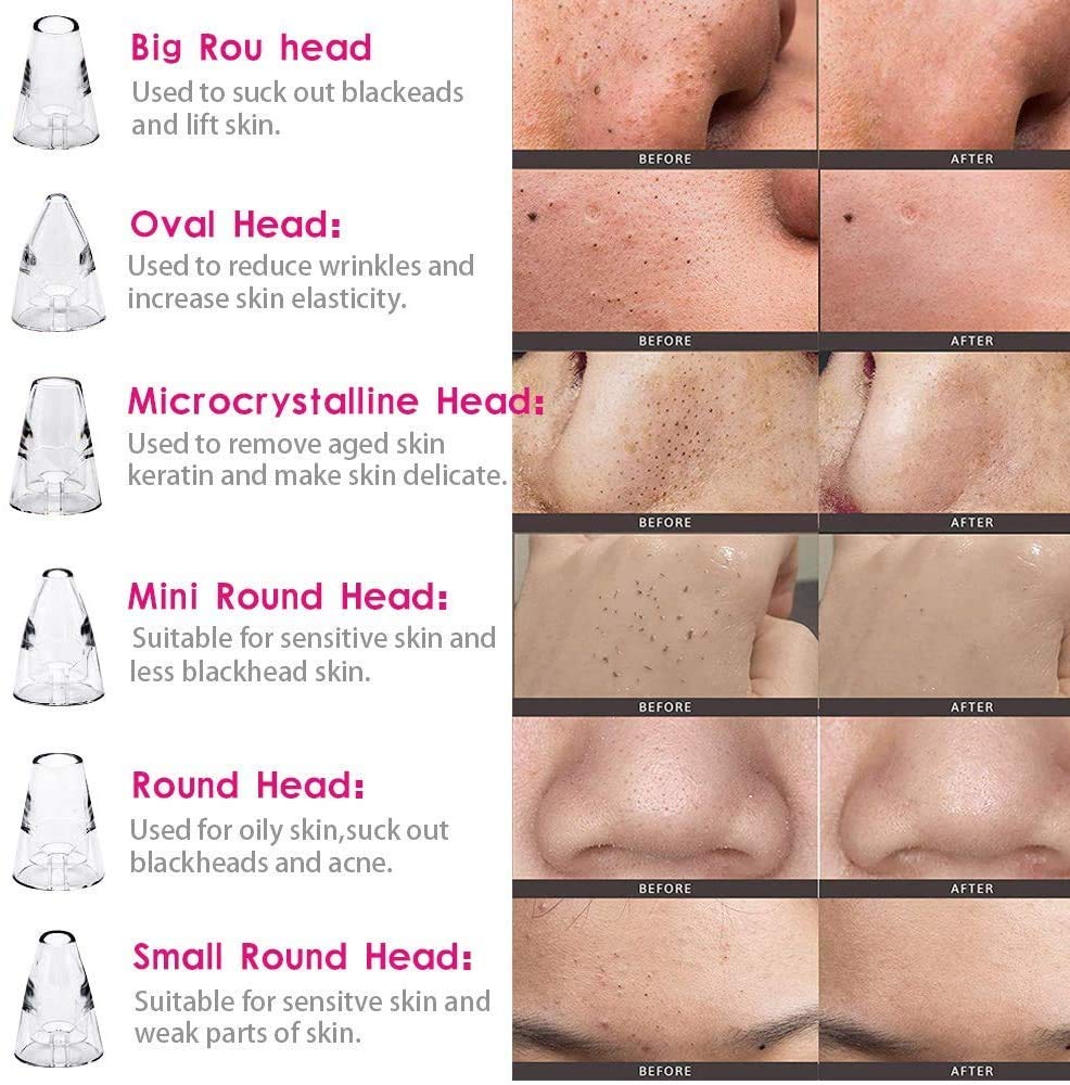 ClearSkin Pro™