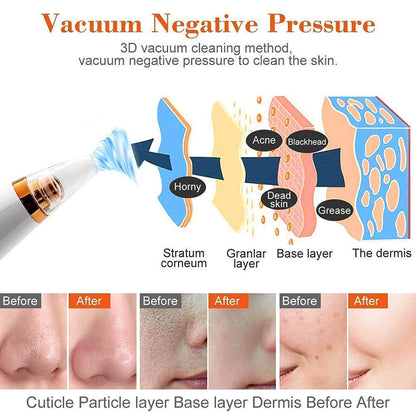 ClearSkin Pro™